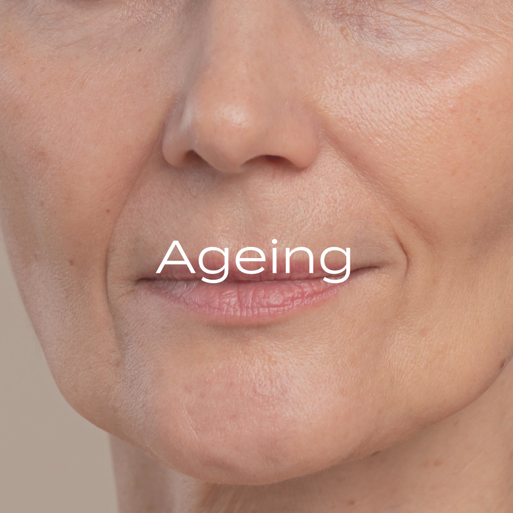 Ageing