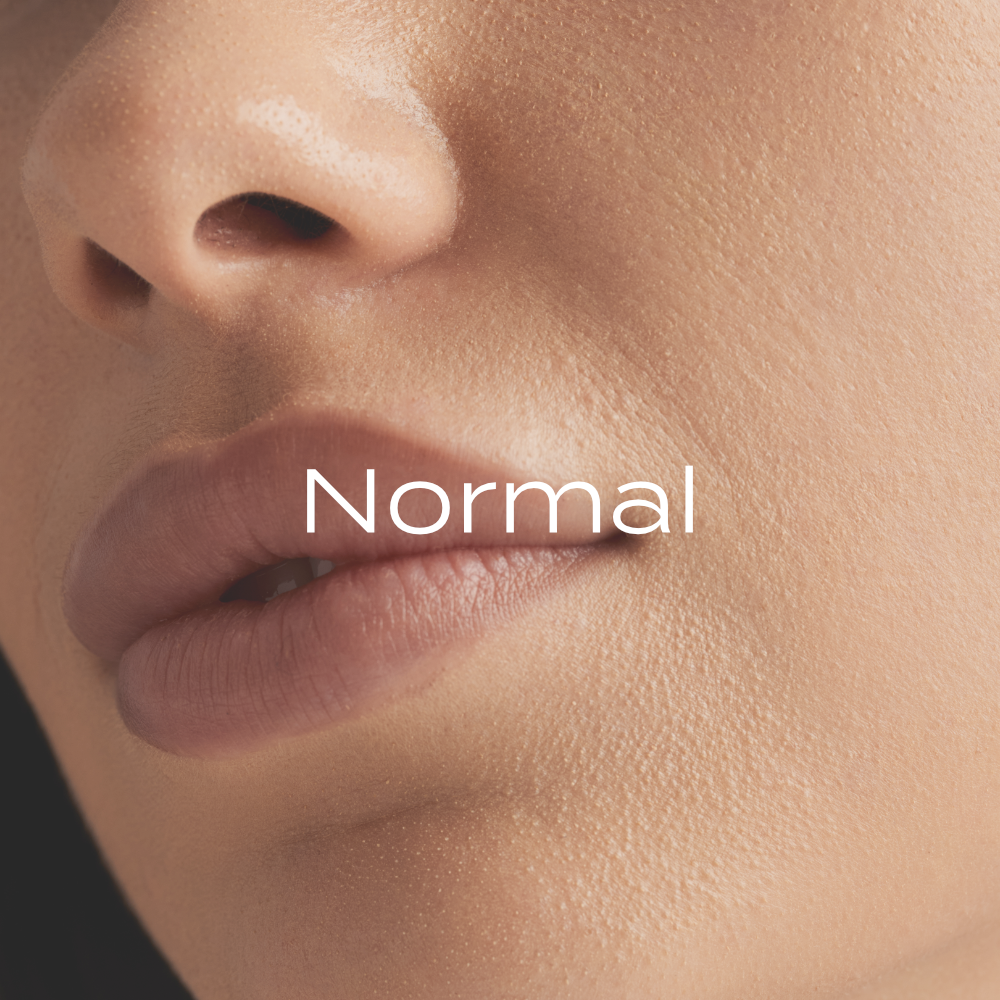 Normal