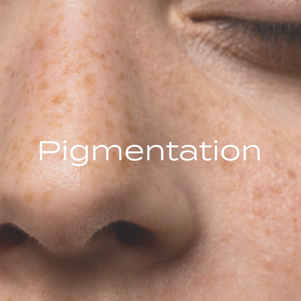 Pigmentation