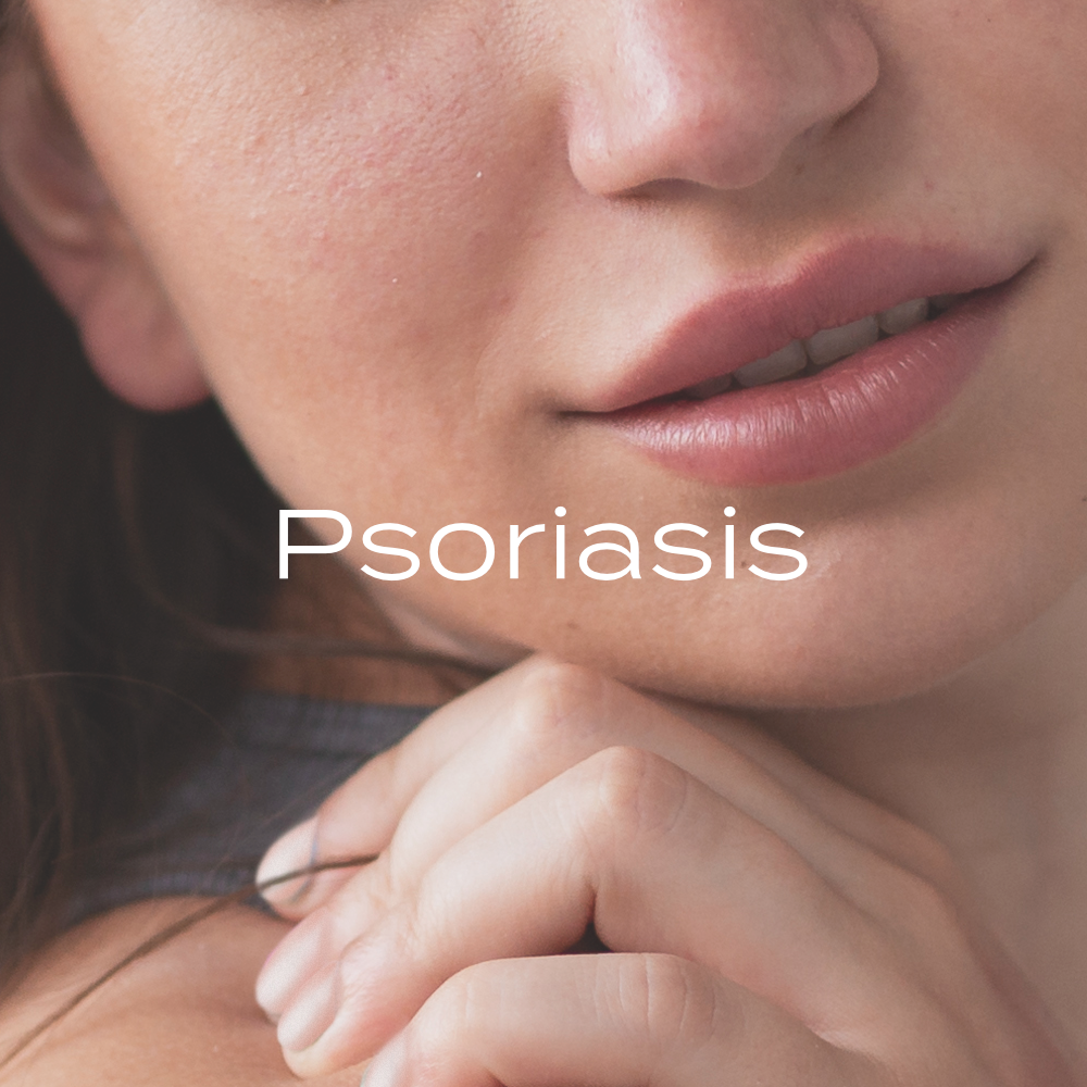 Psoriasis