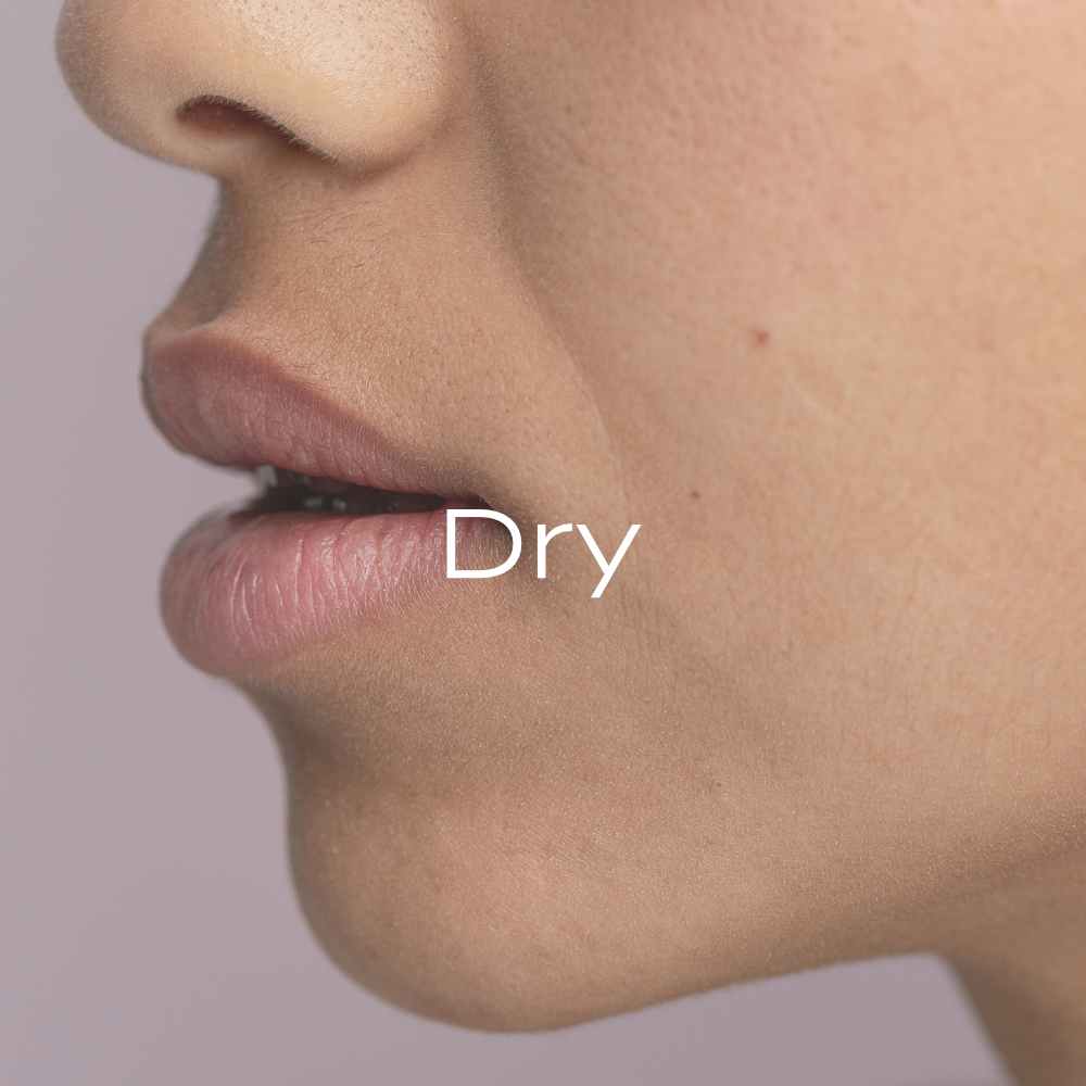 Dry