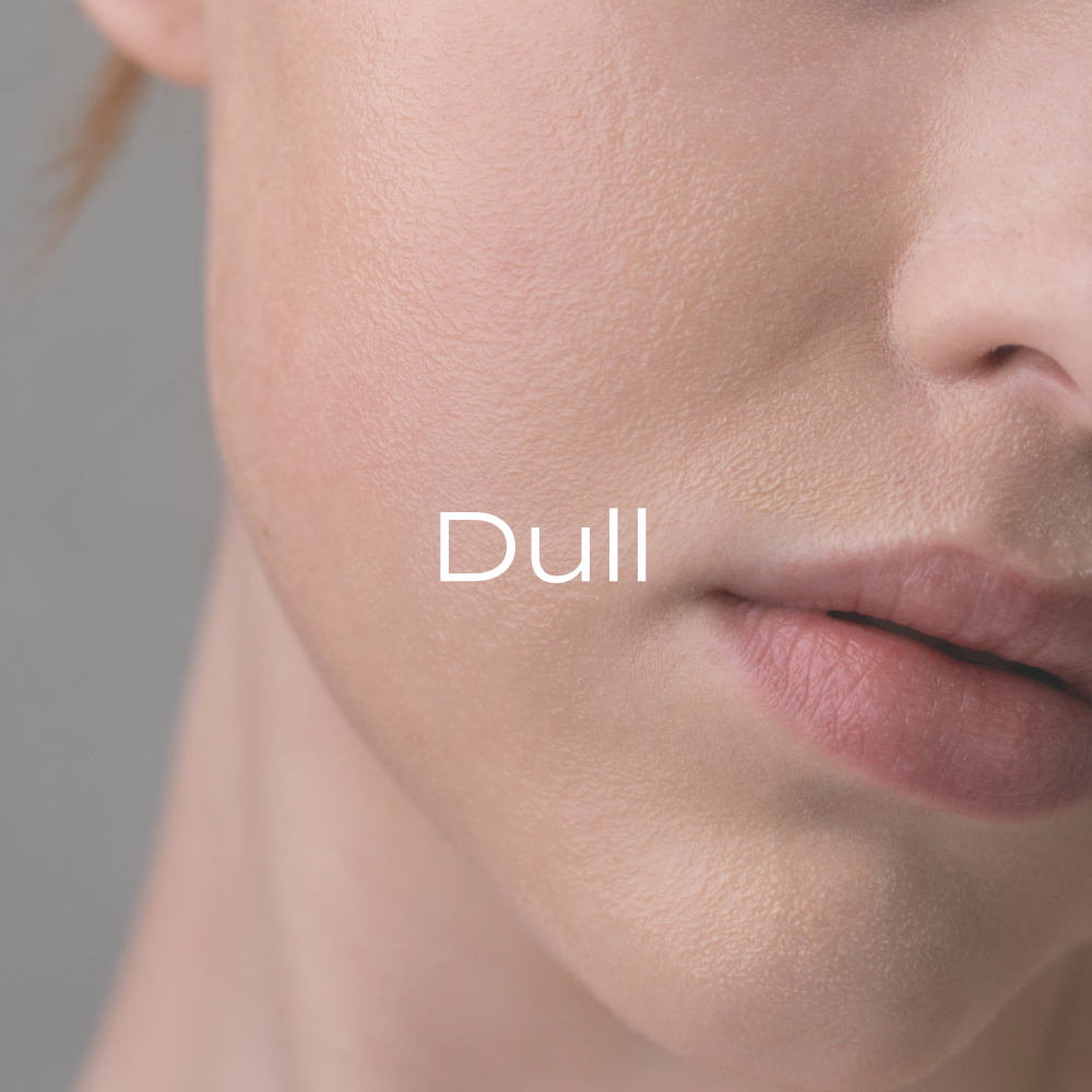 Dull
