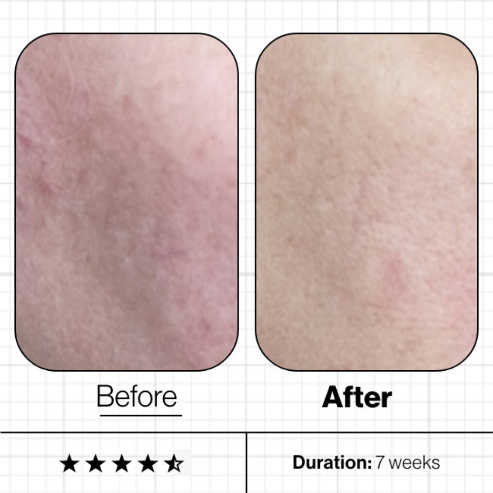 Advanced Nutrition Programme Skin Moisture IQ 28 Day Supply
