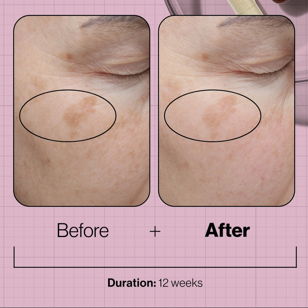 Advanced Nutrition Programme Skin Even IQ 28 day supply