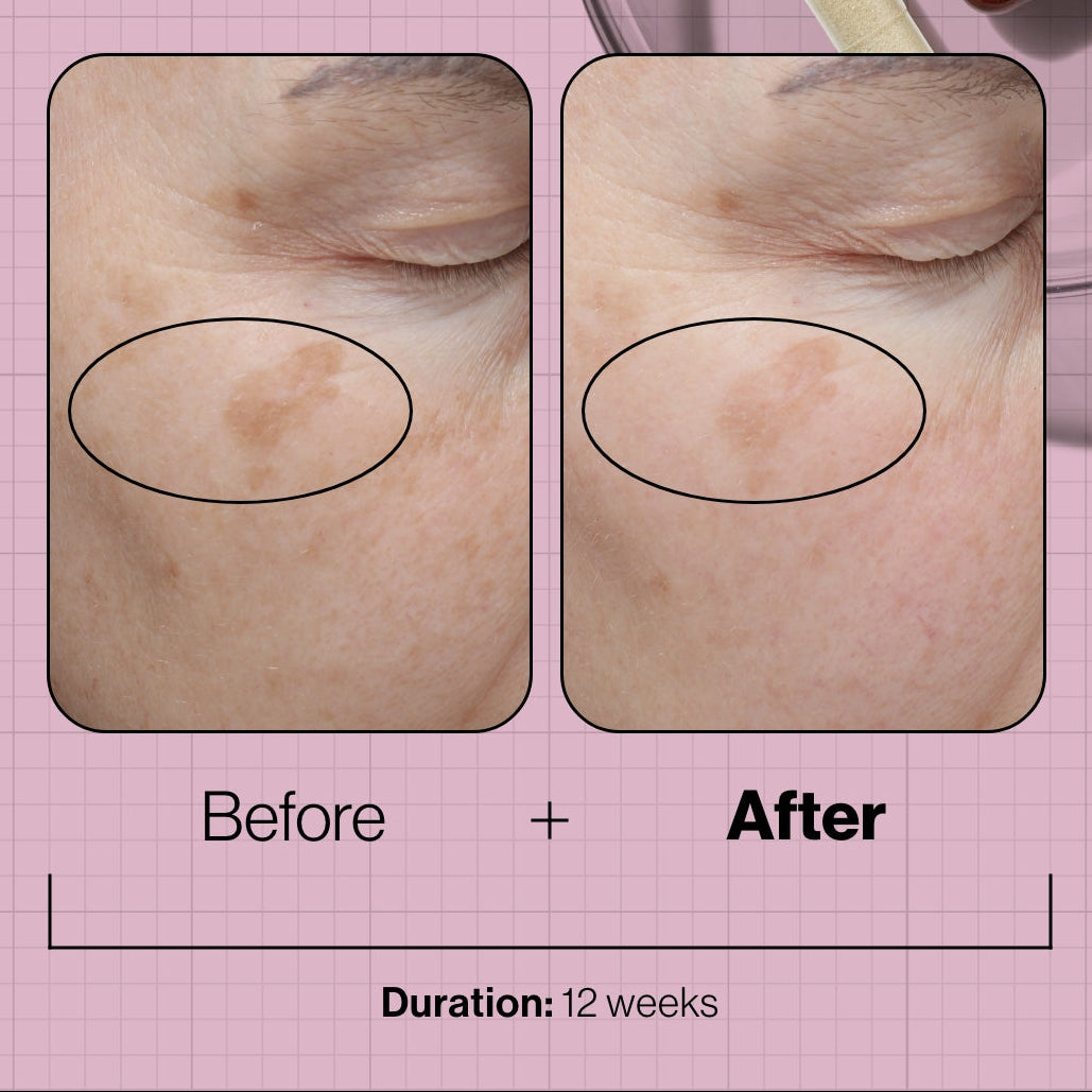 Advanced Nutrition Programme Skin Even IQ 28 day supply